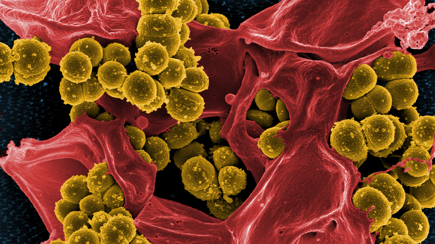  Ein digital nachbearbeitetes Bild einiger multiresistenter Bakterien, Staphylokokken (gelb), aus einem elektronenmikroskopischen Scan © National Institute of Allergy and Infectious Diseases (NIAID) 