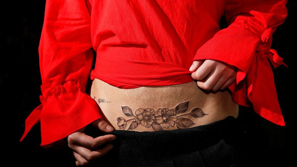 Diese junge Frau hat sich ein Tattoo über ihre Kaiserschnittnarbe stechen lassen. © Aly Song/Reuters