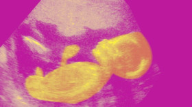  Ein Fötus im Mutterleib, 22 Wochen alt. © BSIP/UIG Via Getty Images 